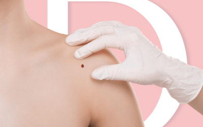 Consulta Dermatológica