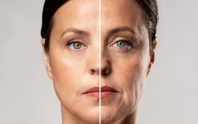 ¿Ya conoces los increíbles beneficios de la Radiofrecuencia? 